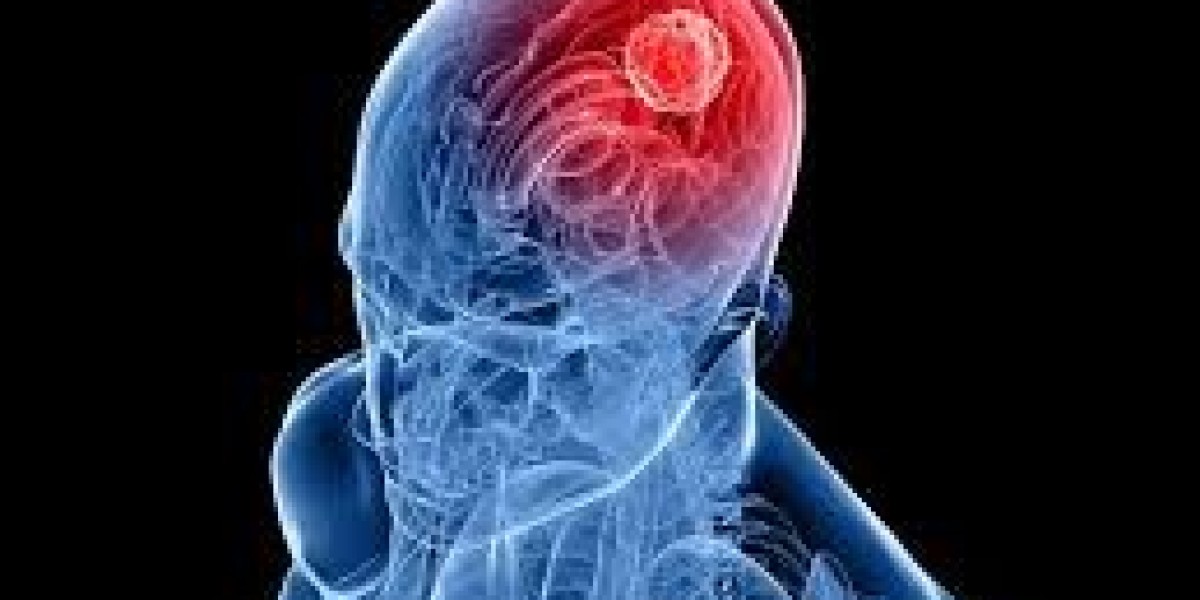 Brain Tumour Treatment in Singapore